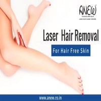 Laser Hair reduction in Bangalore  Anew