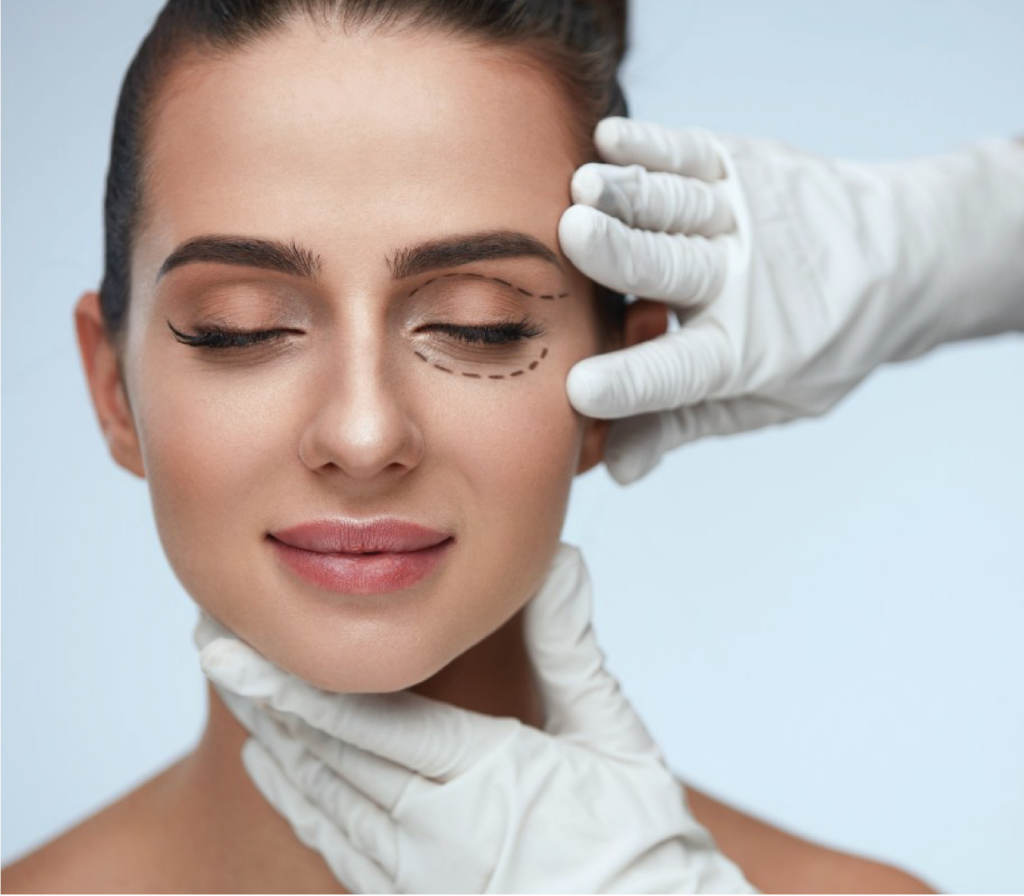 Under Eye Surgery in Brazil   Rosique Plastic Surgery